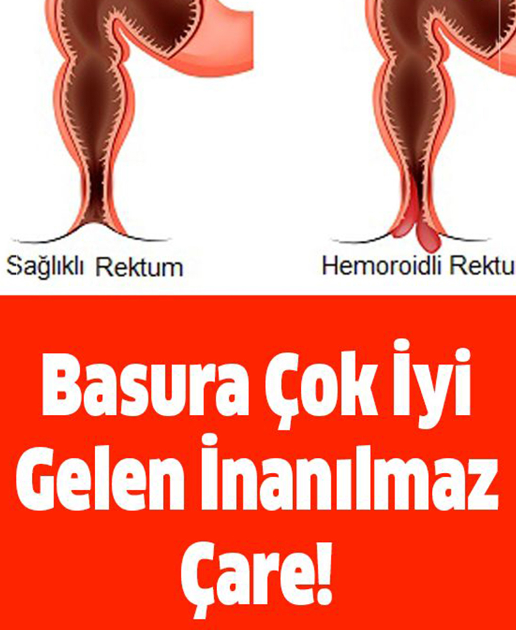 Basura iyi gelen inanılmaz yöntem - 1