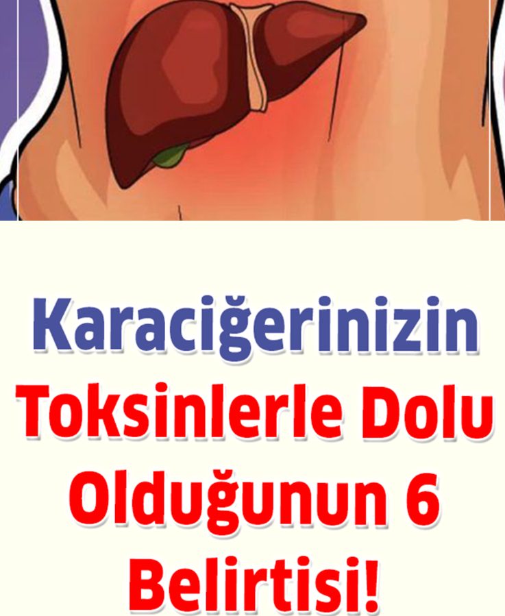 Karaciğerinizin Toksinlerle Dolu Olduğunun 6 Belirtisi - 1