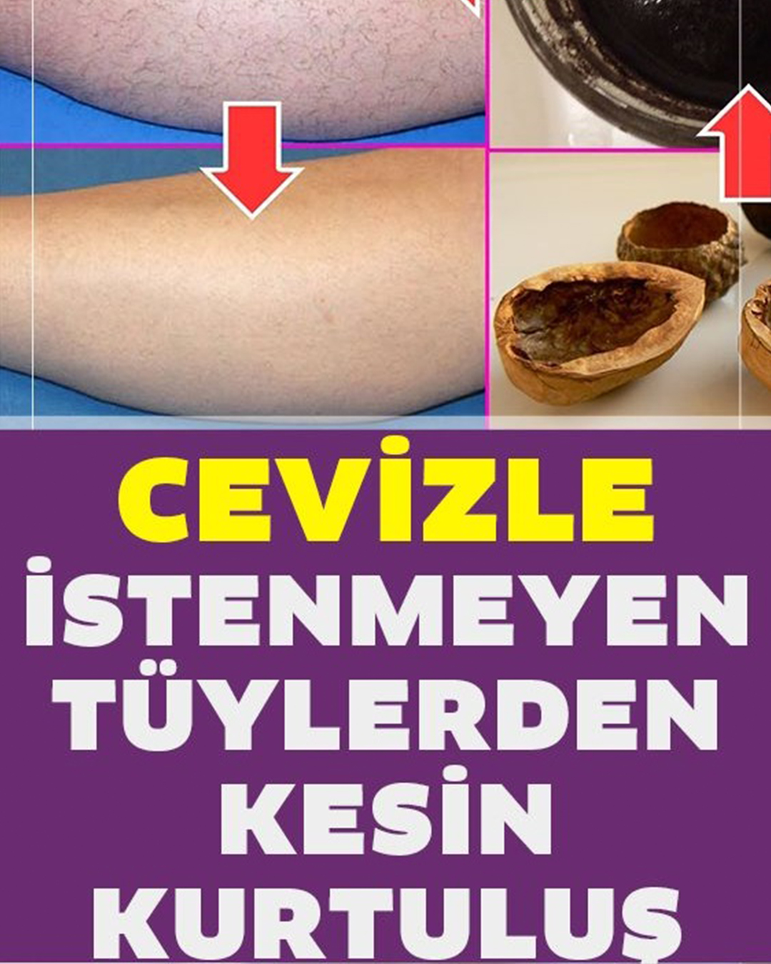 Cevizle İstenmeyen Tüylerden Kurtulmanın Kesin Yolu - 1
