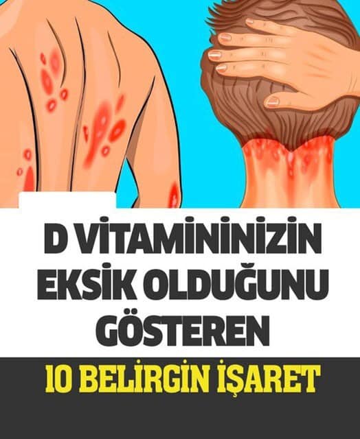D Vitamini Eksikliğiniz Olduğunu Gösteren 10 Belirgin İşaret - 1