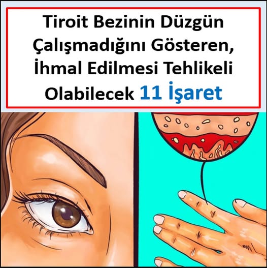 TİROİT BEZİNİN DÜZGÜN ÇALIŞMADIĞINI GÖSTEREN, İHMAL ETMESİ TEHLİKELİ OLABİLECEK 11 İŞARET - 1