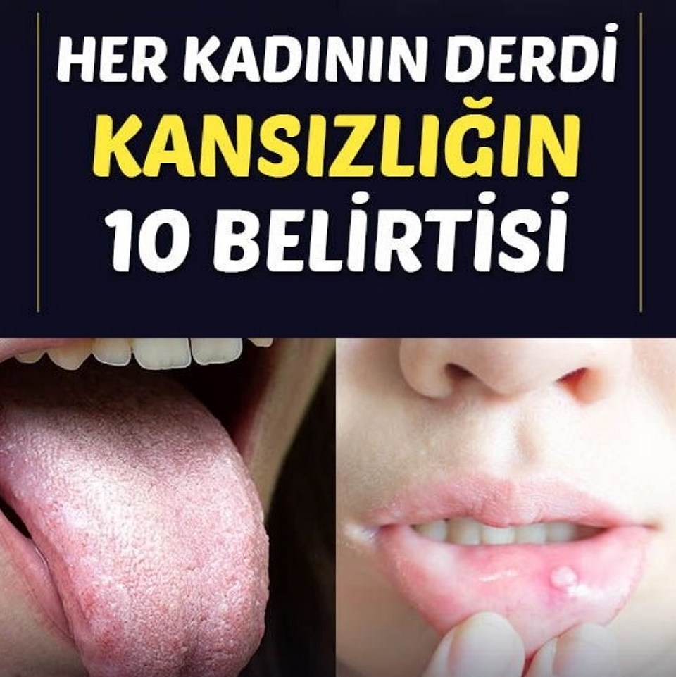 İŞTE KANSIZLIĞIN 10 BELİRTİSİ - 1