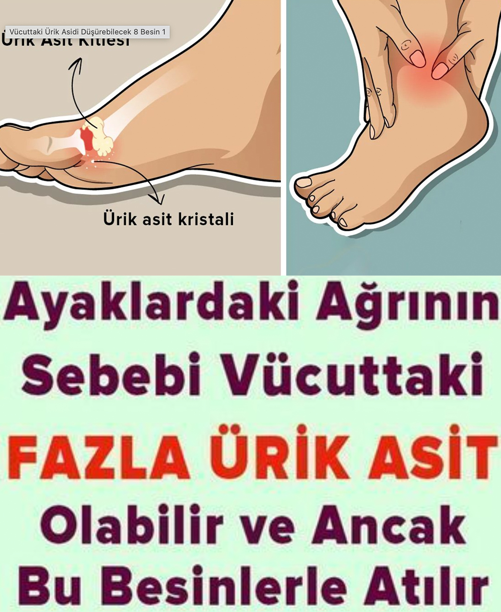 Ayaklardaki Ağrının Sebebi Ürik Asit Olabilir - 1