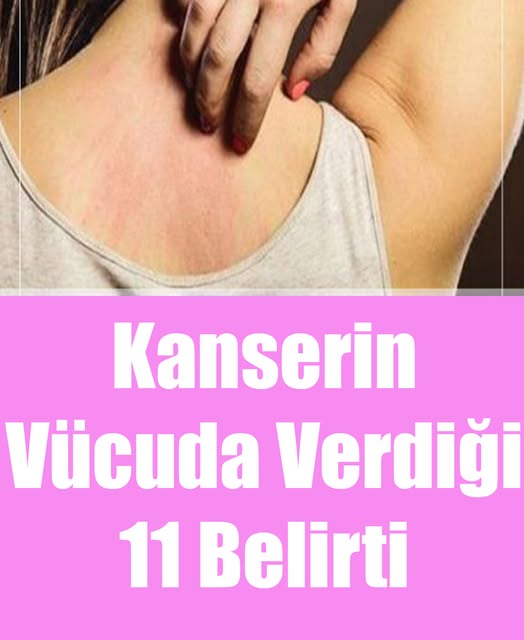Kanserin Vücuda Verdiği 11 Belirti - 1