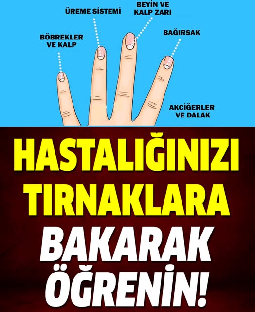 Tırnaklarınızın size anlattığı 13 sağlık sorununa dikkate alın - 1