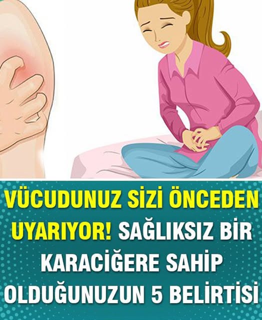 Sağlıksız Bir Karaciğere Sahip Olduğunuzun 5 Belirtisi - 1