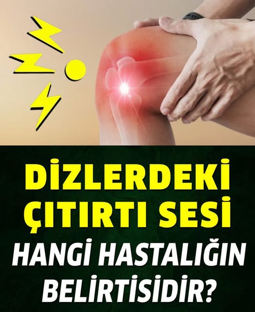 Diz kapağındaki çıtırtı sesi neyin belirtisi, neden olur?  Bilgi İlk Yorumda - 1