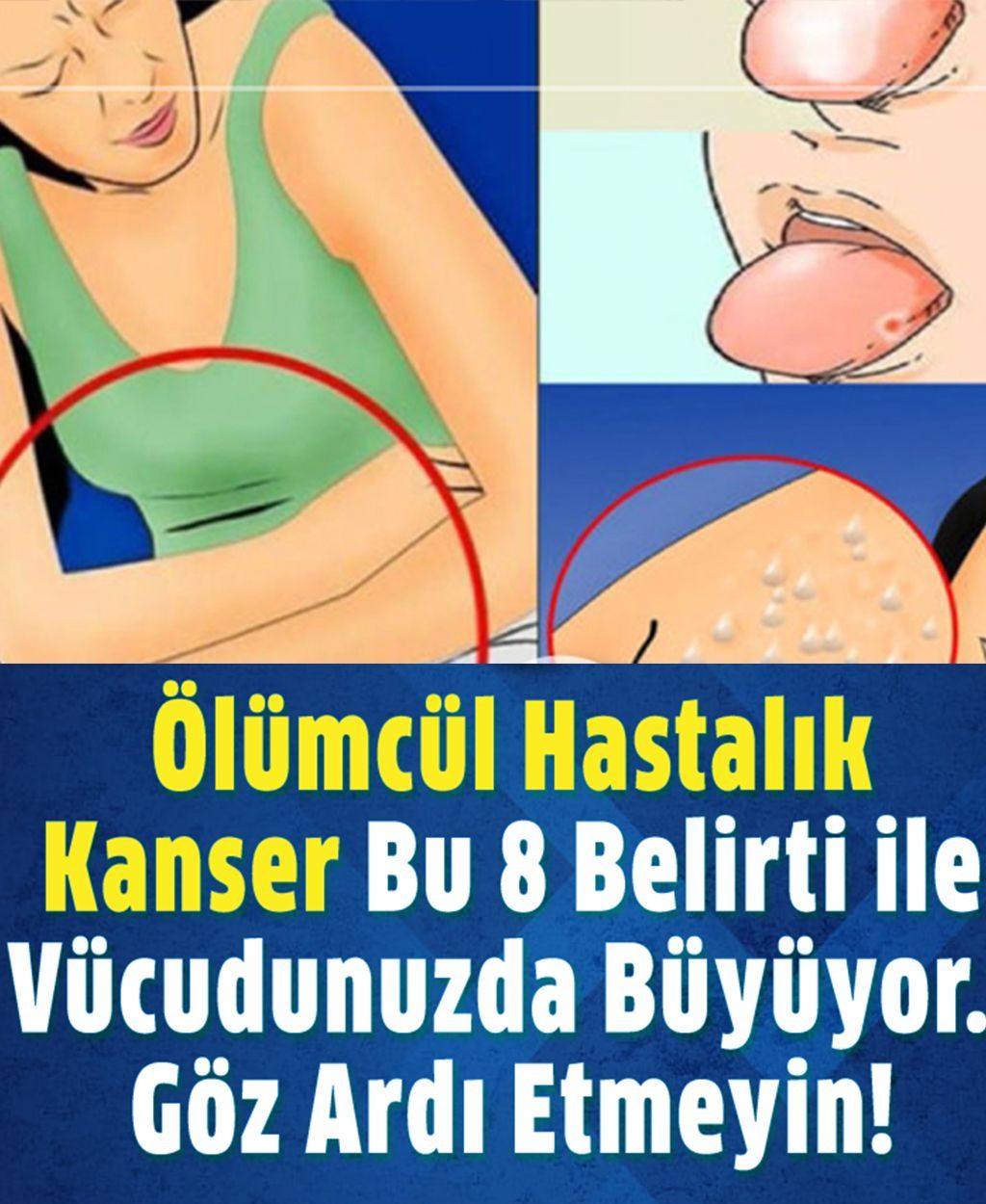Kanserin Vücuda Verdiği 8 Belirti - 1