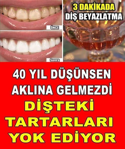 40 SENE DÜŞÜNSENİZ AKLINIZA BİLE GELMEZ DİŞTEKİ PLAĞI TARTARI YOK EDİYOR - 1