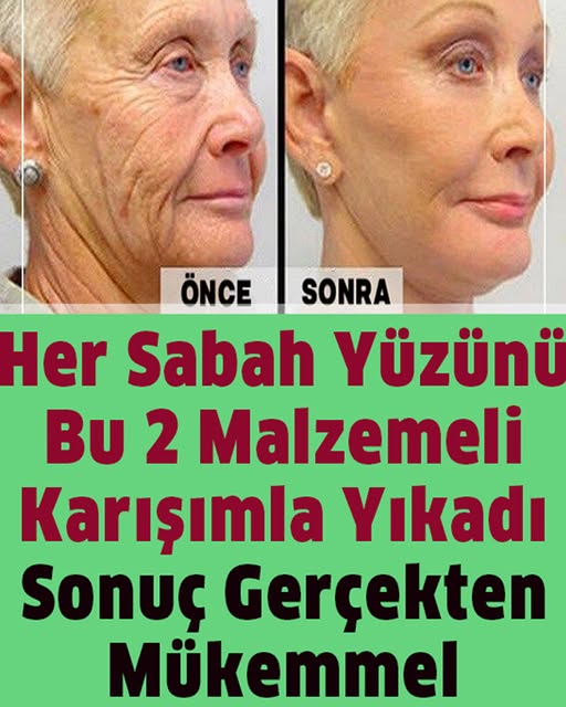 Her Sabah Yüzünüzü Bu 2 Malzemeli Karışımla Yıkayın - 1