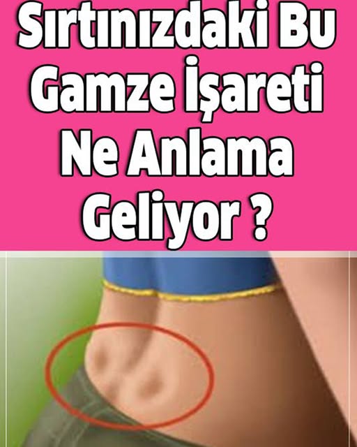 Sırtınızdaki Bu Gamze İşareti Ne Anlama Geliyor - 1