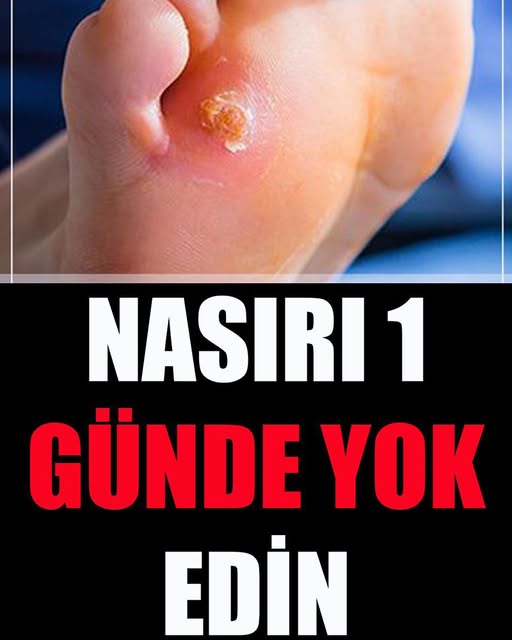 Nasırı 1 Günde Yok Edin - 1