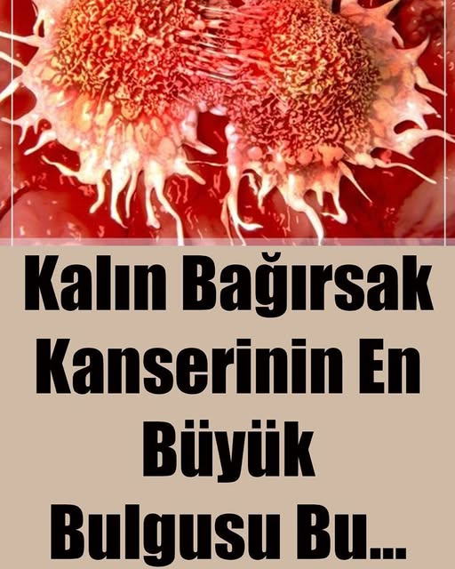 Kalın Bağırsak Kanserinin En Büyük Bulgusu  - 1