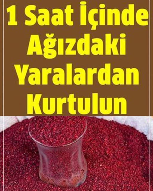 Ağızdaki Yaraları 1 Saat İçinde Yok Ediyor - 1