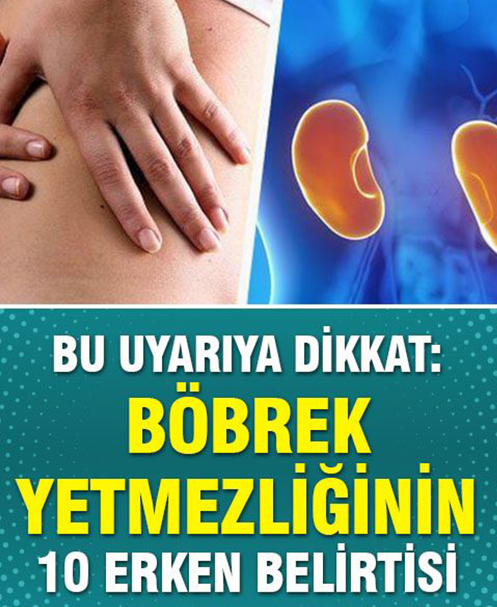 Böbrek Yetmezliğinin 10 Erken Belirtisi	 - 1