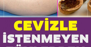 Cevizle İstenmeyen Tüylerden Kurtulmanın Kesin Yolu