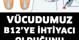 Vücudumuz B12’ye İhtiyacı Olduğunu Böyle Anlatır