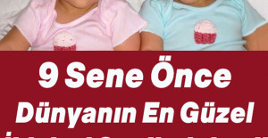 9 Sene Önce Dünyanın En Güzel İkizleri Seçilmişlerdi Şimdiki Halini Görenler İnanamıyor
