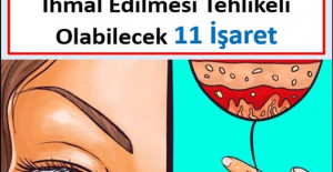 TİROİT BEZİNİN DÜZGÜN ÇALIŞMADIĞINI GÖSTEREN, İHMAL ETMESİ TEHLİKELİ OLABİLECEK 11 İŞARET