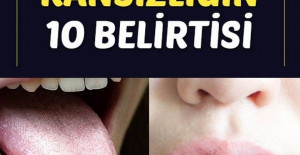 İŞTE KANSIZLIĞIN 10 BELİRTİSİ