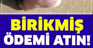 Bedeninizdeki Birikmiş Ödemi Atmak Ne Kadar Faydalı