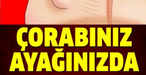 Çorabınız Ayağınızda İz Bırakıyorsa Dikkat