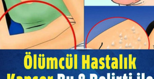 Kanserin Vücuda Verdiği 8 Belirti