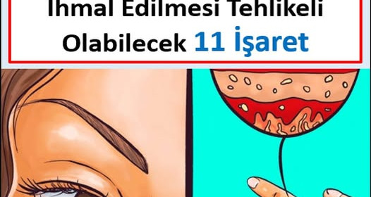 TİROİT BEZİNİN DÜZGÜN ÇALIŞMADIĞINI GÖSTEREN, İHMAL ETMESİ TEHLİKELİ OLABİLECEK 11 İŞARET