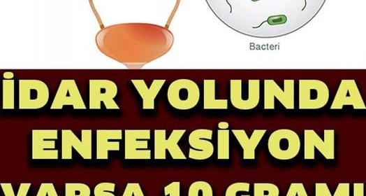 İdrar Yolu Enfeksiyonunu Geçiren 7 Doğal Yöntem