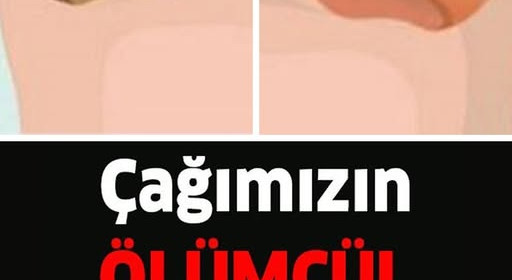 Çağın Hastalığı Akciğer Kanserinin Belirtileri