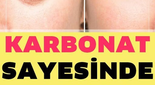 Karbonat İle 10 Yaş Genç Görünün