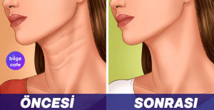 Boyun Çizgilerinizi Yok Edecek ve Sizi Genç Gösterecek Yöntemler