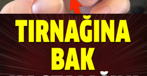 Tırnağına bak hastalığı anla	