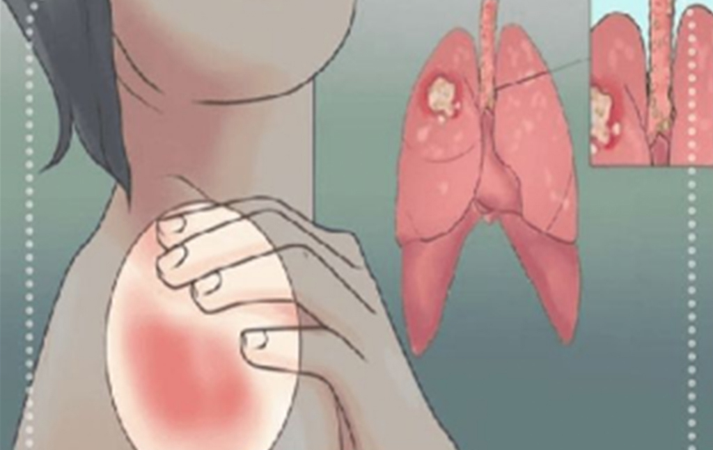 Kadınlarda belirtileri nelerdir - 3