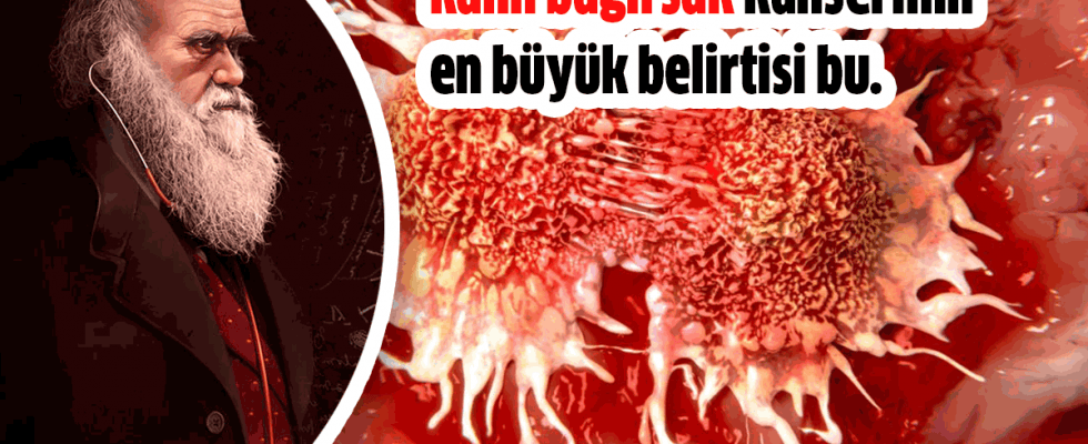 Kalın Bağırsak Kanserinin En Büyük Bulgusu  - 3