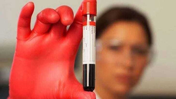 İŞTE KANSIZLIĞIN 10 BELİRTİSİ - 3