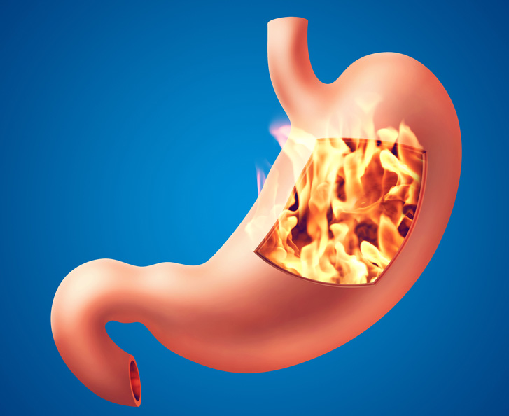 Mide Şişkinliği Ve Hazımsızlığın Asıl Sebebi	 - 2