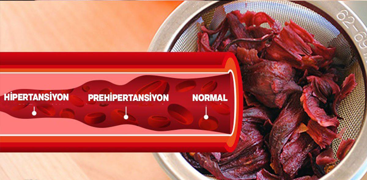 Tansiyonu Düşüren Baharatlar Herkes Bilmeli	 - 2