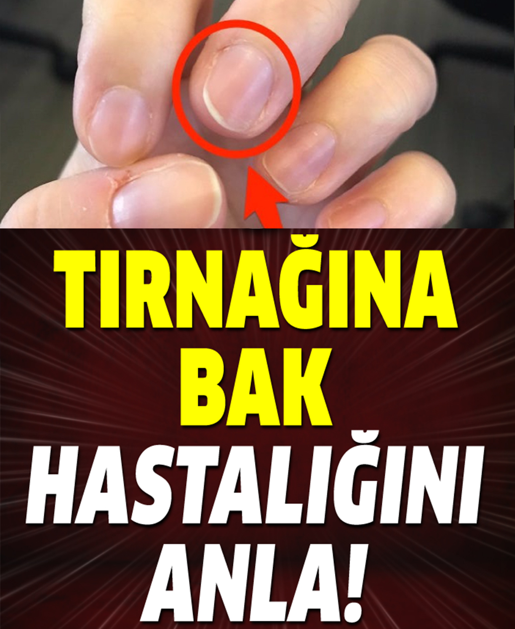 Tırnağına bak hastalığı anla	 - 1