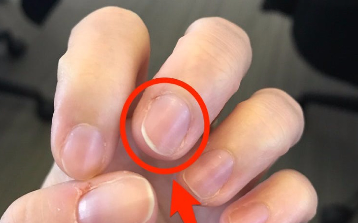 Tırnağına bak hastalığı anla	 - 3